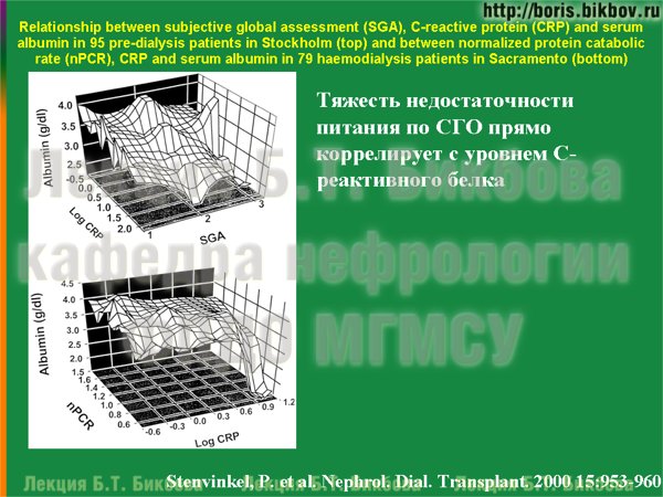 Тяжесть недостаточности питания по СГО прямо коррелирует с уровнем С-реактивного белка 