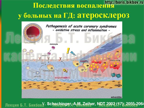 Последствия воспаления у больных на гемодиалзе: атеросклероз