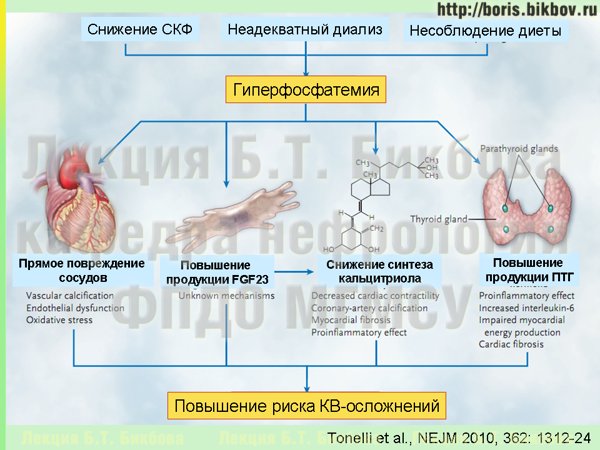 Последствия высокого уровня фосфатов крови при ХБП - вторичный гиперпаратиреоз, внекостная кальцификация, подавление синтеза кальцитриола, увеличение риска кардиоваскулярных осложнений