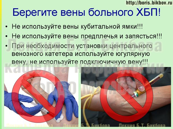 Как не надо пунктировать вены у больных с хронической болезнью почек Как не рекомендуется пунктировать вены у больных с хронической болезнью почек